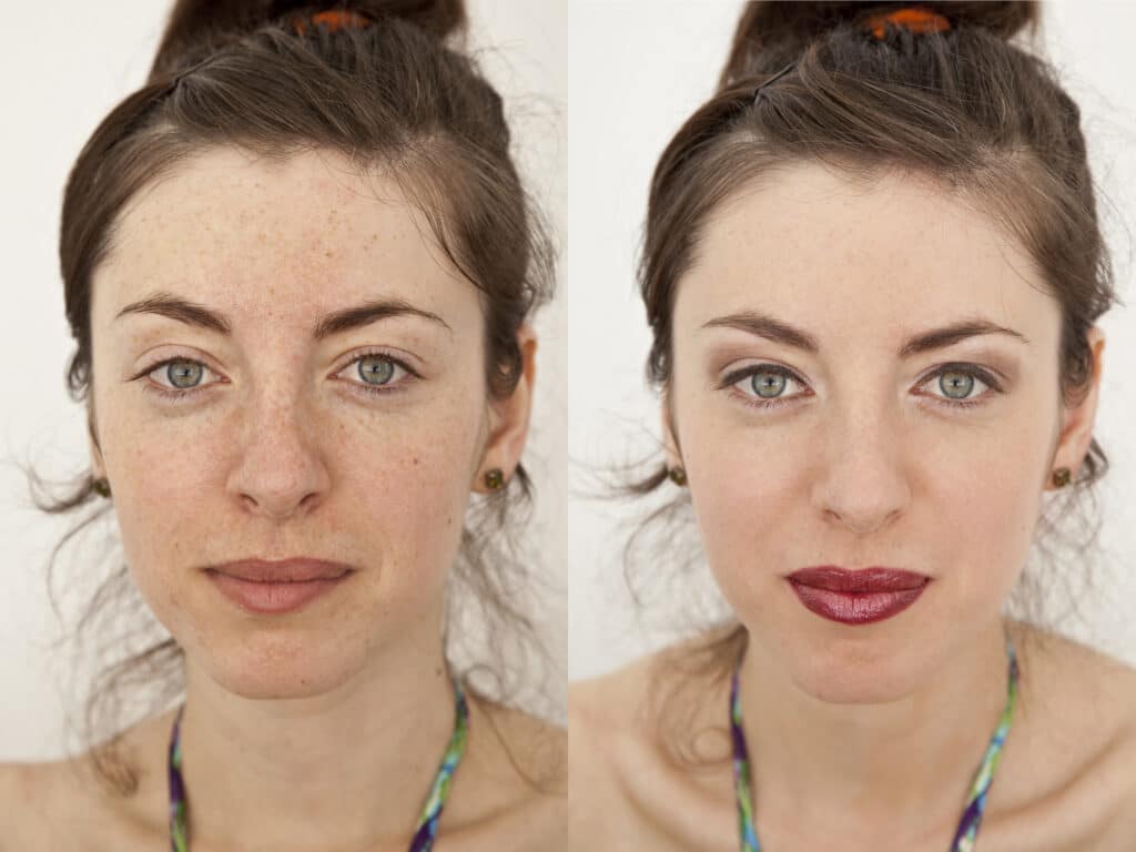 Before and After IPL Photofacial College Station TX