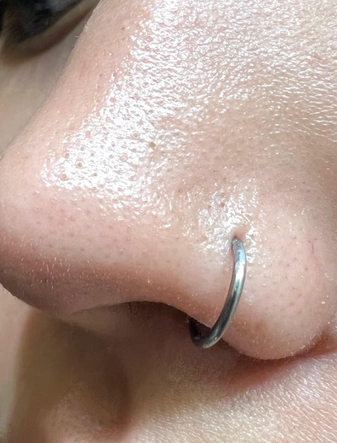 After Image: Deluxe Hydrafacial - front