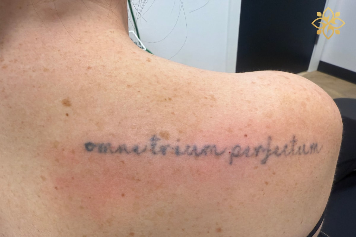 Before Image: Before & After - back