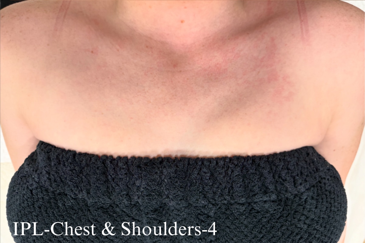 After Image: Before & After - front