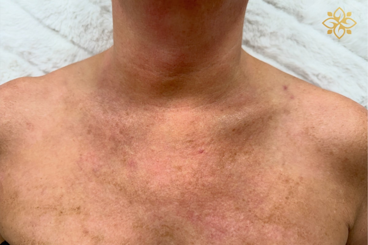 Before Image: Before & After - front