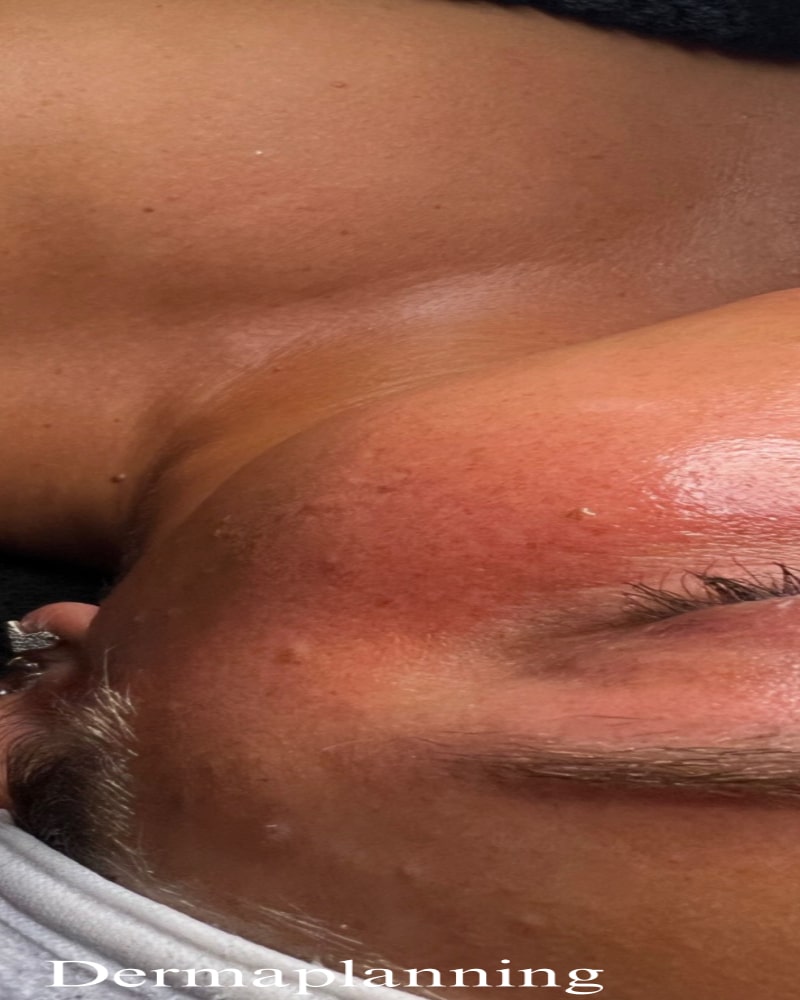 Before Image: Before & After - front