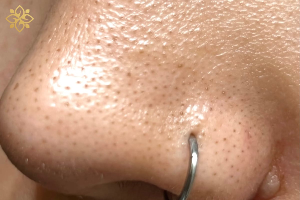 Before Image: Before & After - left-front-oblique