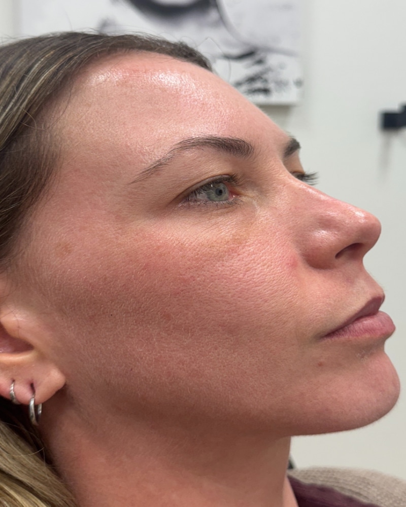 Before Image: Before & After - right-front-oblique