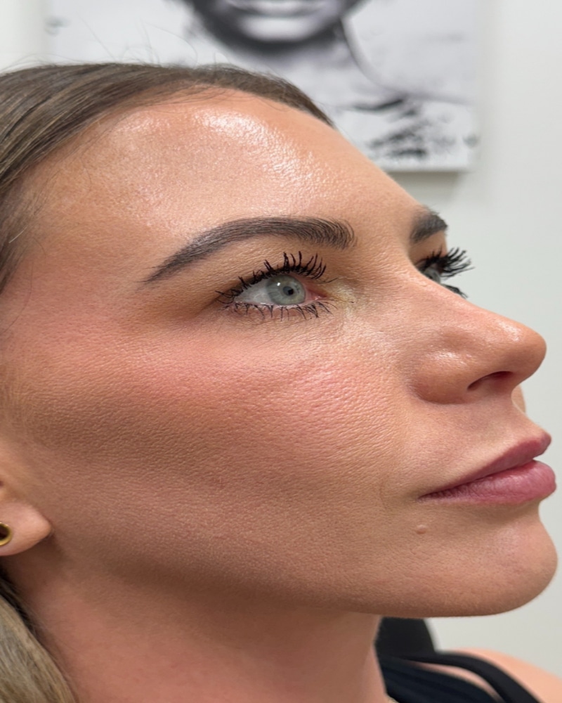 After Image: Before & After - right-front-oblique