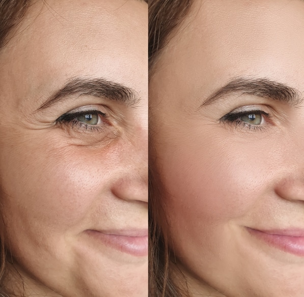 Injectables, Filler Services in College Station & Bryan, TX