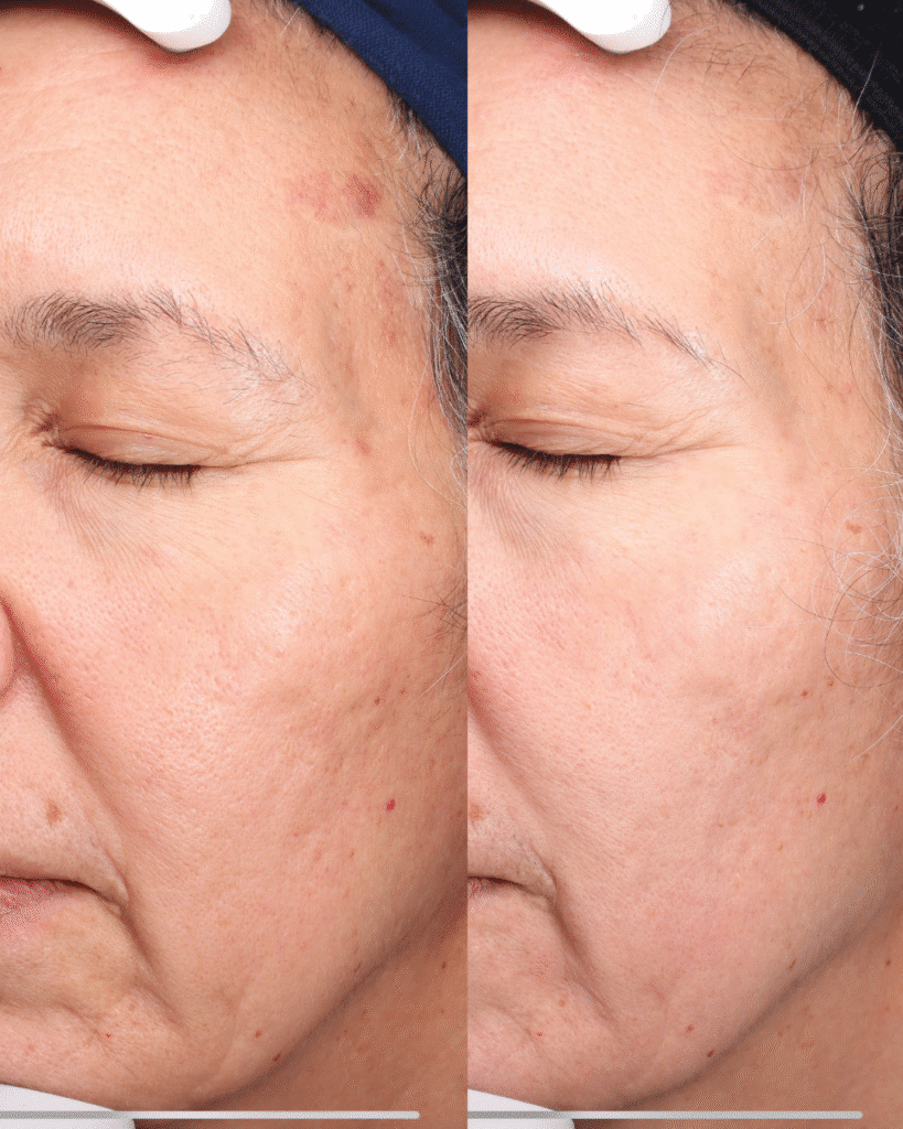 Skin Care Treatments in College Station & Bryan, TX